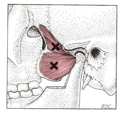 pressure points post nasal drip